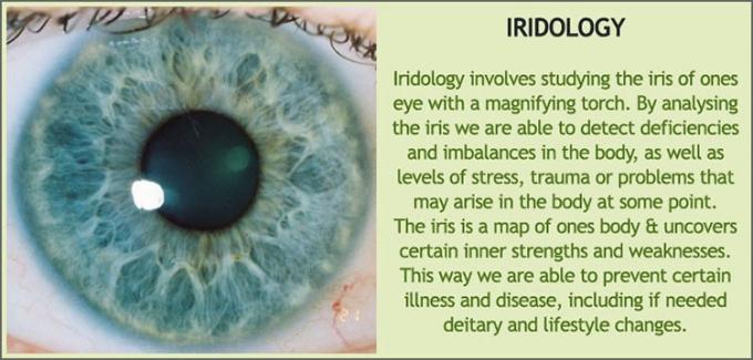 iridology 홍채 진단